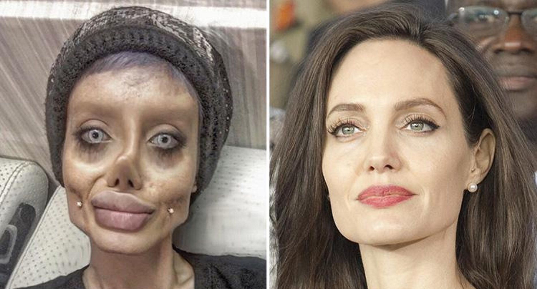 Woman undergoes 50 surgeries to look like Angelina Jolie. See pics of her drastic transformation.