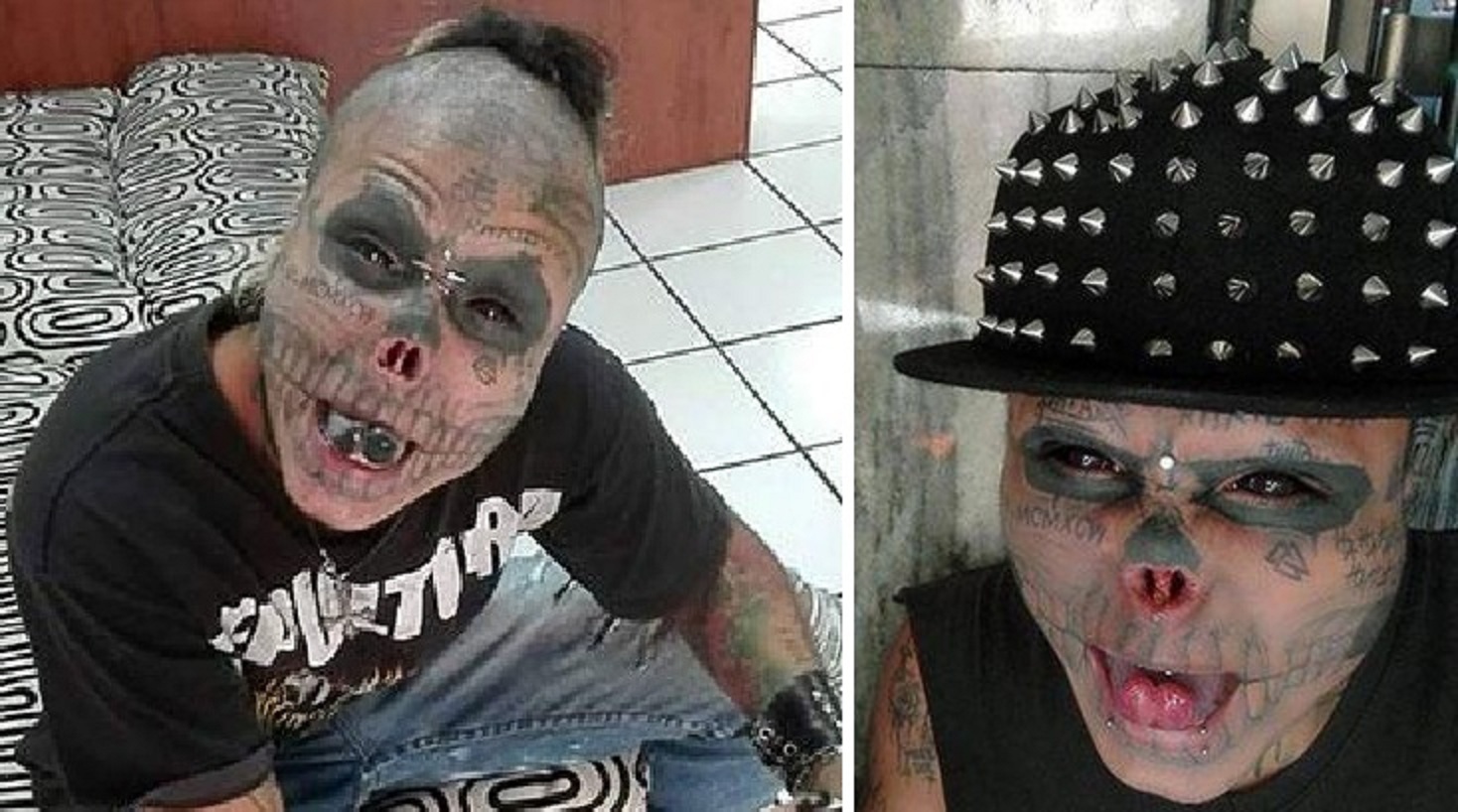 22 Year Old Man gets his Nose Cut-Off to Look Like a Skull