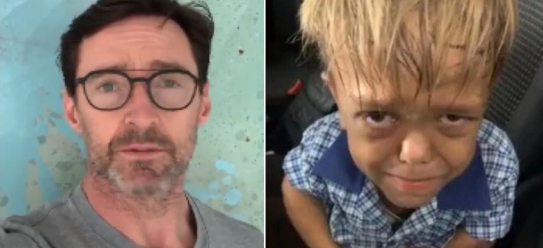 Hugh Jackman & More Celebs Come Out in Support Of Bullied Kid – Quaden Bayles