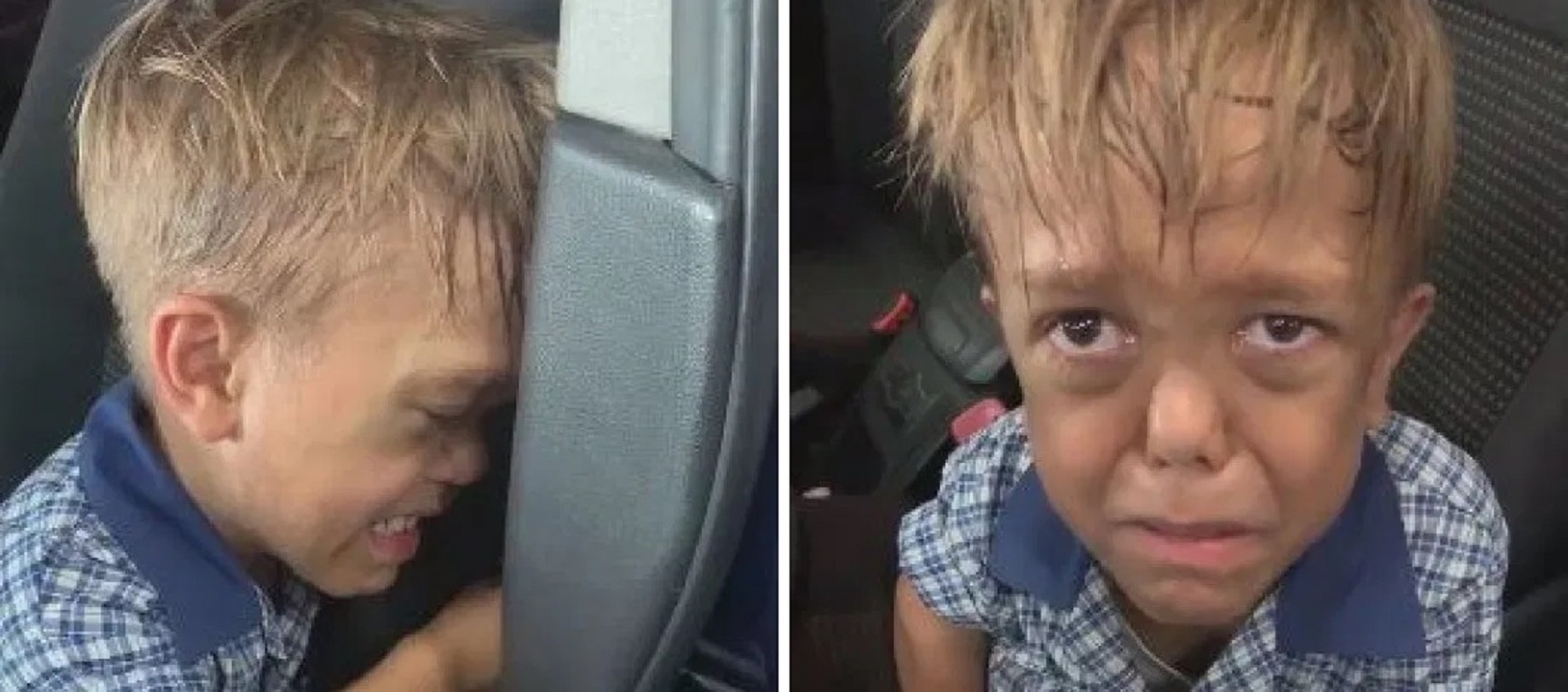 9 Year Old Boy Talks About ‘Killing Himself’ After Being Bullied in School For Dwarfism